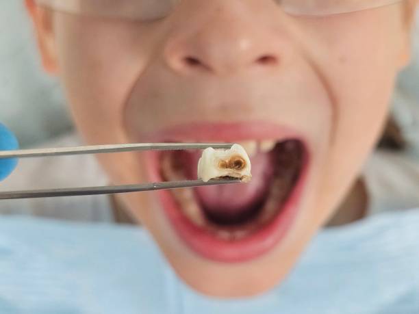 Best Emergency Pediatric Dental Care in Many, LA