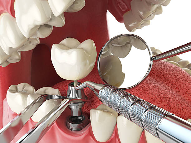 Best Emergency Dental Clinic in LA